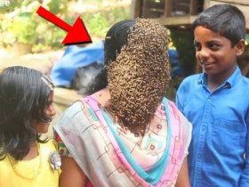 한 여성이 얼굴을 꿀벌로 덮은 채 사는 기상천외한 이유