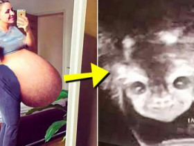 한 부부의 아이를 ‘대리 임신’한 20대 대리모가 초음파 사진 보자 깜짝 놀란 이유