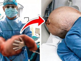 12년동안 한번도 똥을 싸지 않은 남자, 의사들이 그의 몸 속에서 발견한 놀라운 정체…