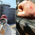 일본 후쿠시마에서 자원봉사하던 한국인 노동자의 손 상태..